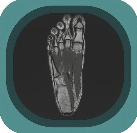 MRI foot anatomy icon